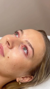 Hydrated glowing skin after hydrofacial Northern Beaches